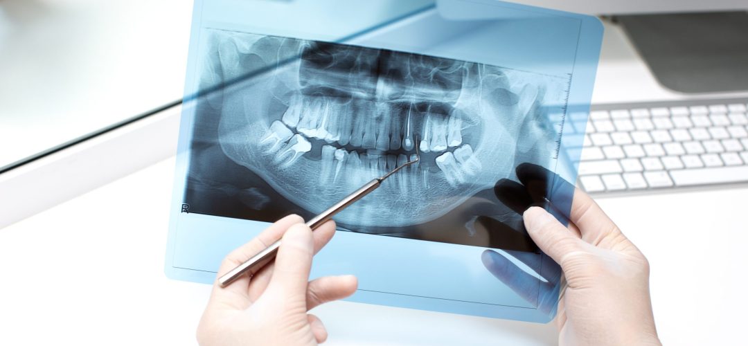 dentist analyzes x ray photo