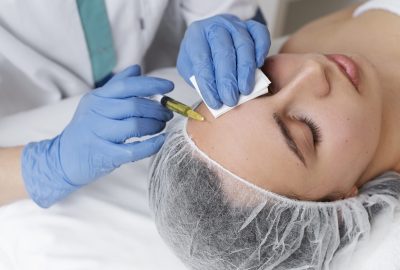 woman-getting-face-prp-treatment-high-angle